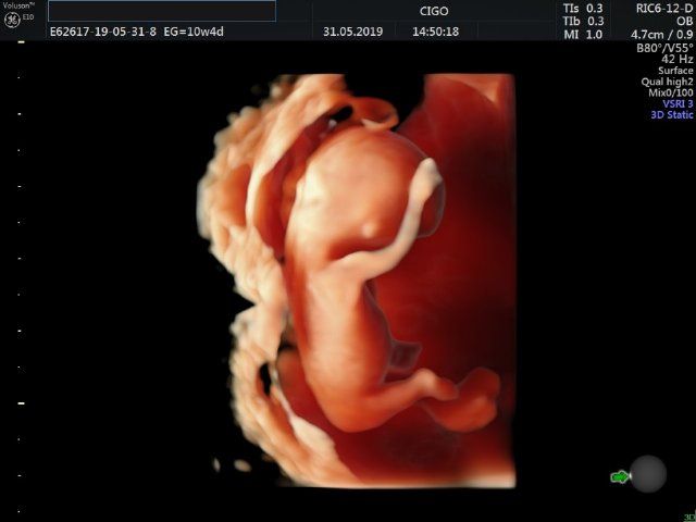 Raul Javier Banderas Pumarino-16