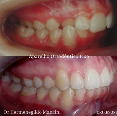 Hermenegildo Mancini-1