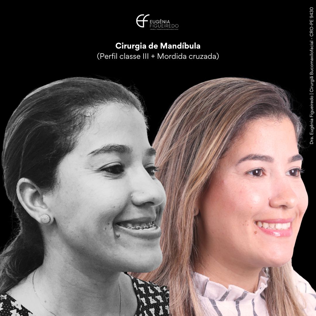 Eugênia Figueiredo-39