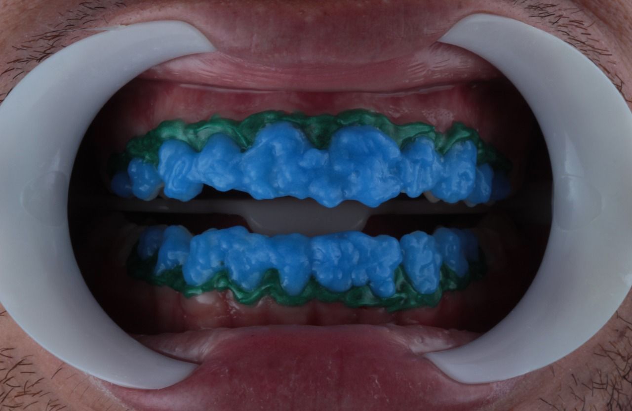 Daniel De Souza Pereira-38