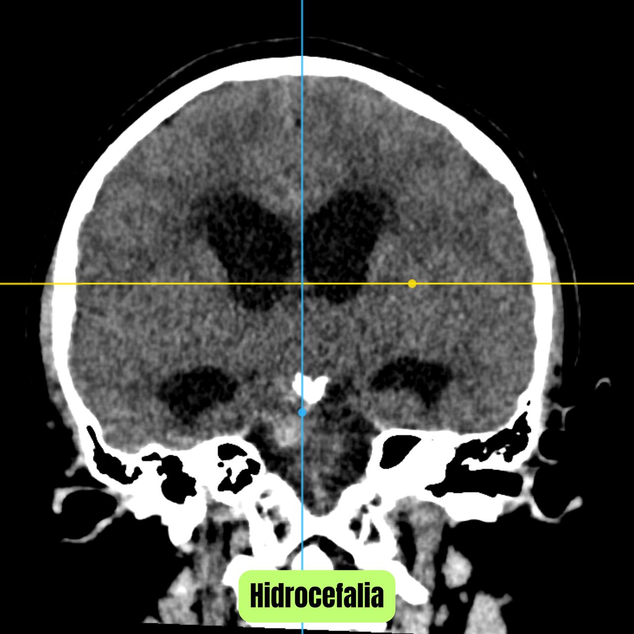 David Tafur Muñoz-1796