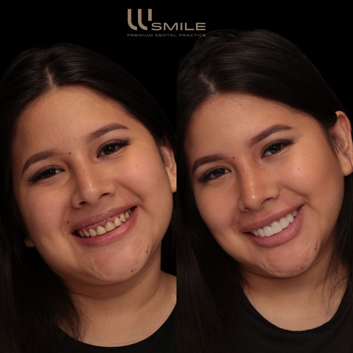 Wesly Mejia-30