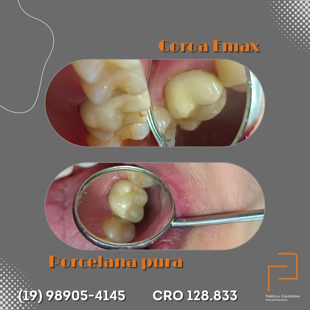 Fabíola Calderan-11