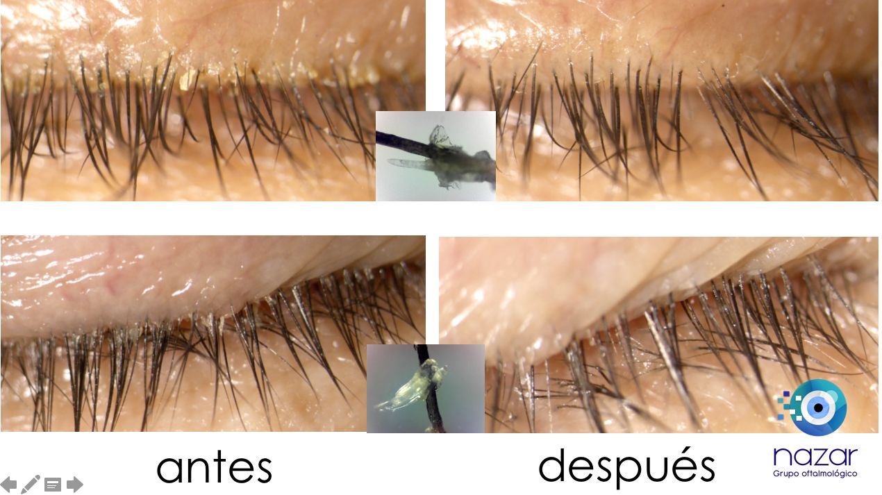 Juan Guillermo Gaviria Carvajal-35