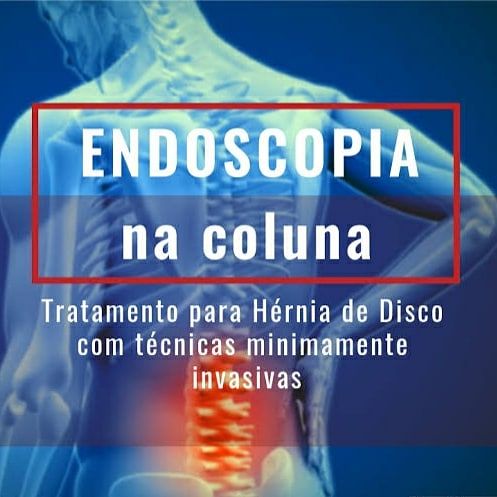 Urbano Chamadoiro-12