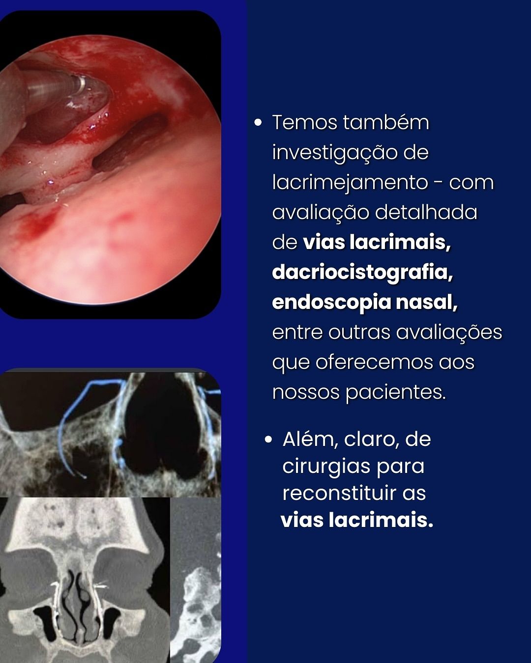 Araê De Oliveira-12