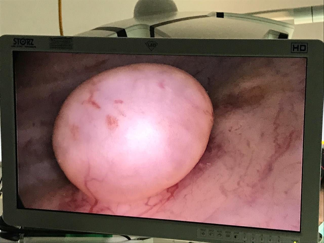 Juan Guillermo Velásquez López-8