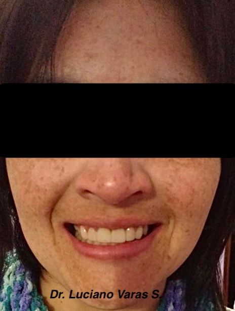 Luciano Varas Salinas-13