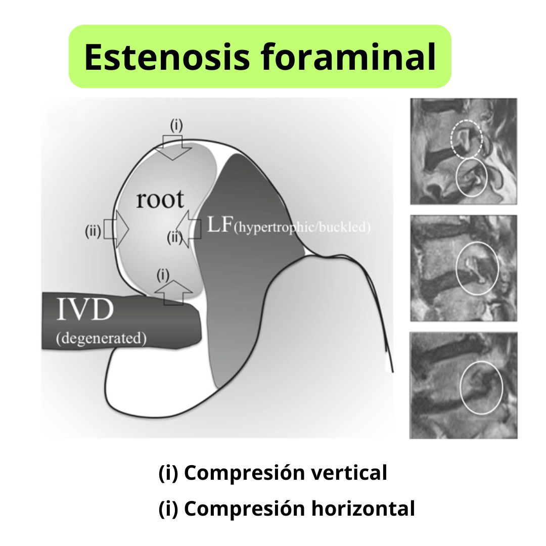 David Tafur Muñoz-2320