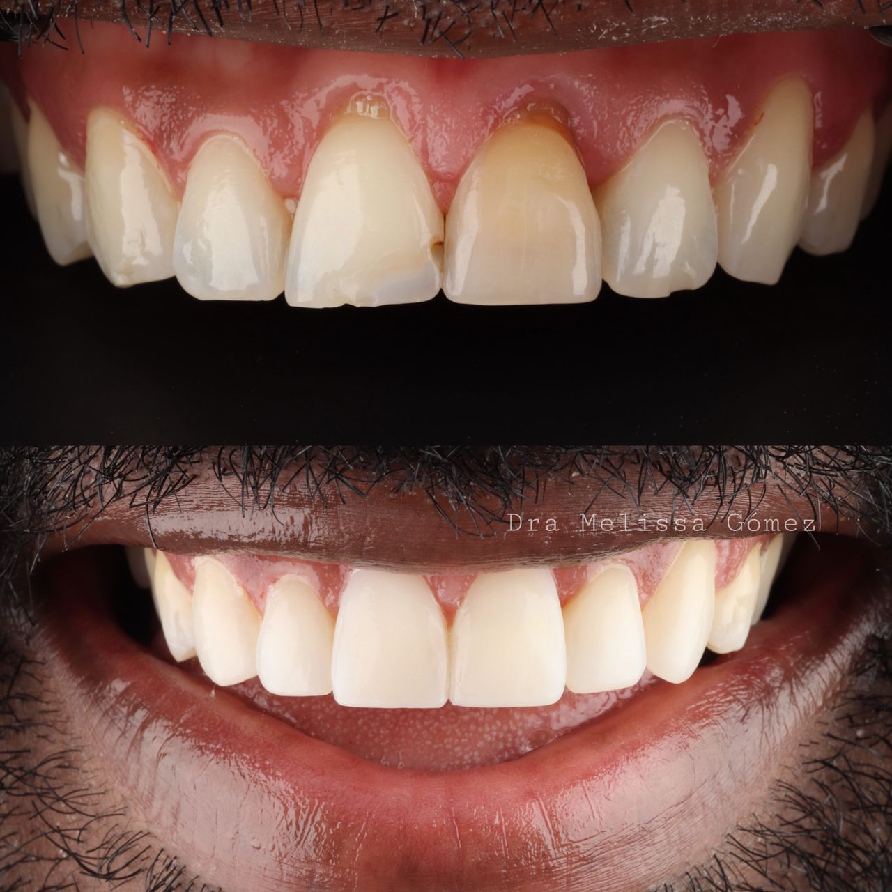 Melissa Gómez Arango-15