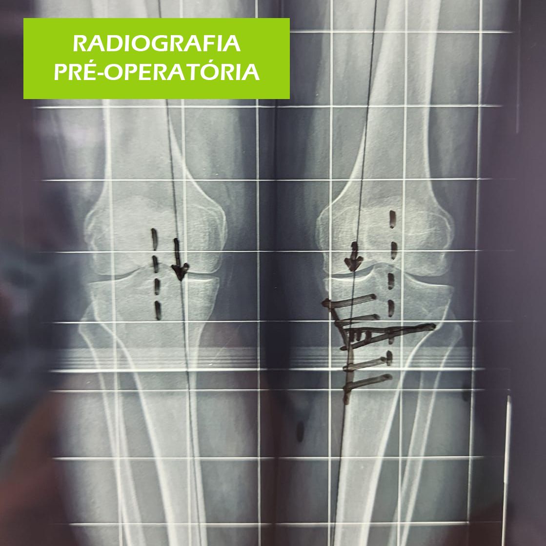 Paulo Roberto Capelletti-46