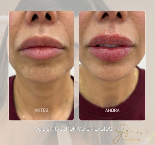 Jasiel Sarai Salas Gomez-0