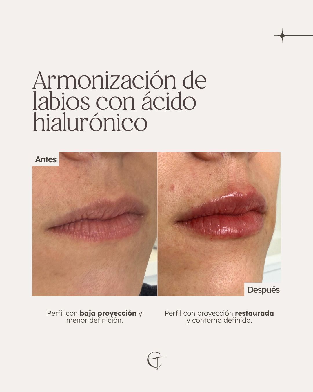 Catalina Trujillo -4