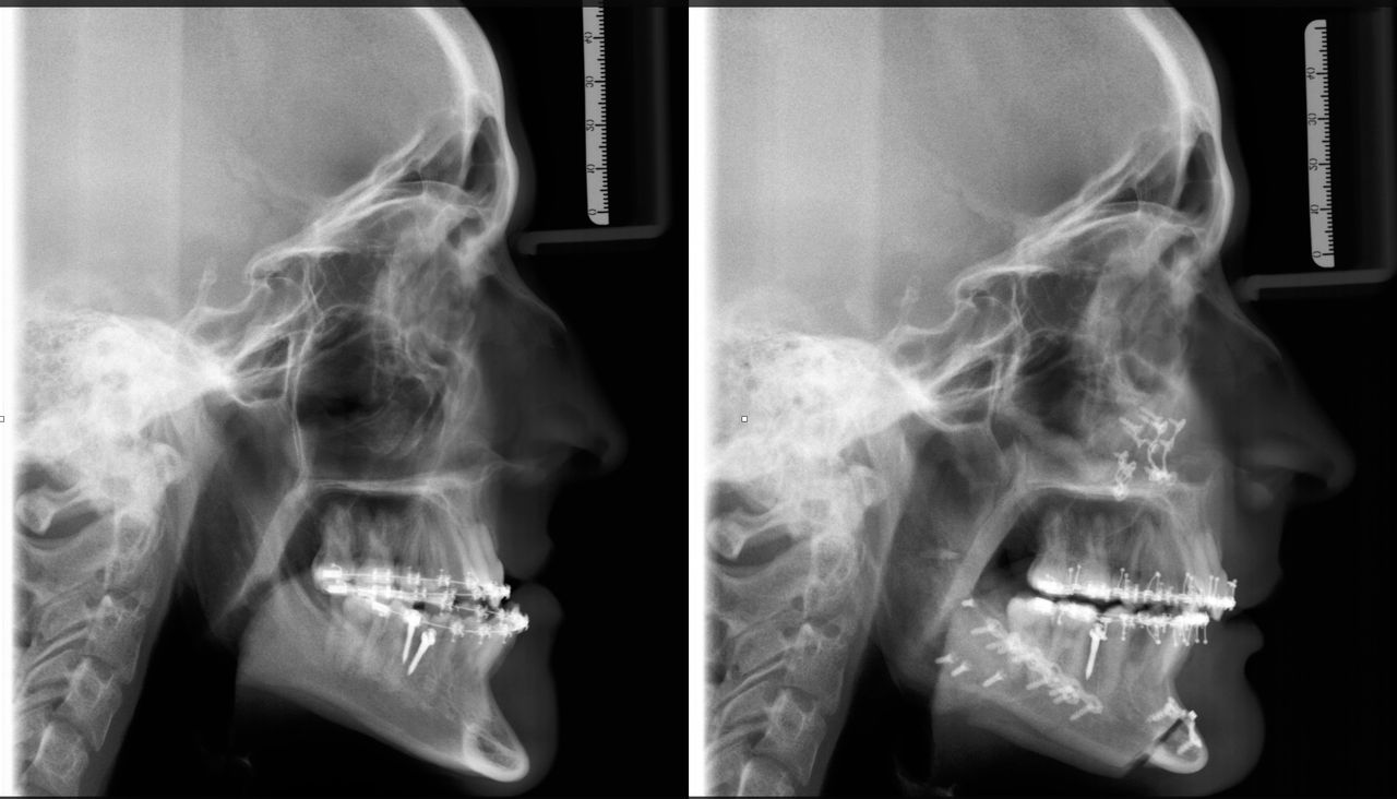 Jorge Eduardo Leyva Beltrán-1