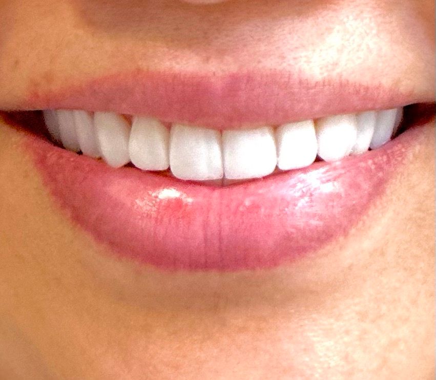 Fanny Valera Velásquez-57