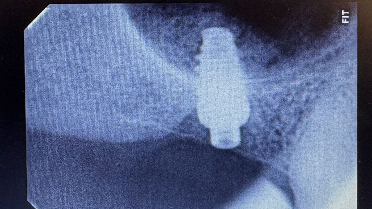 Joel Anderson Valverde Rebaza-9