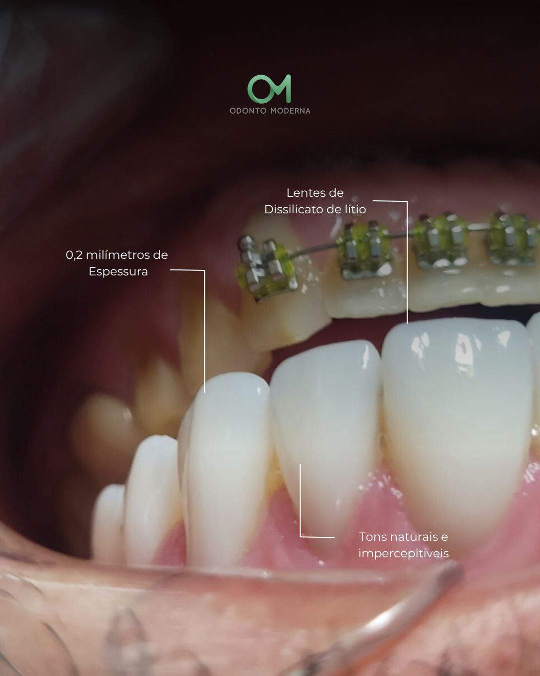Ary Fernandes Da Rocha Filho-1