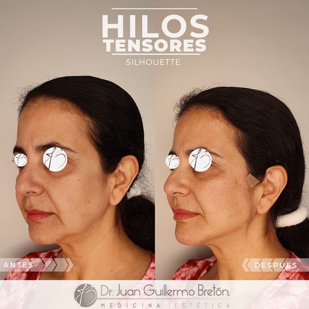 Juan Guillermo Bretón Franco-9