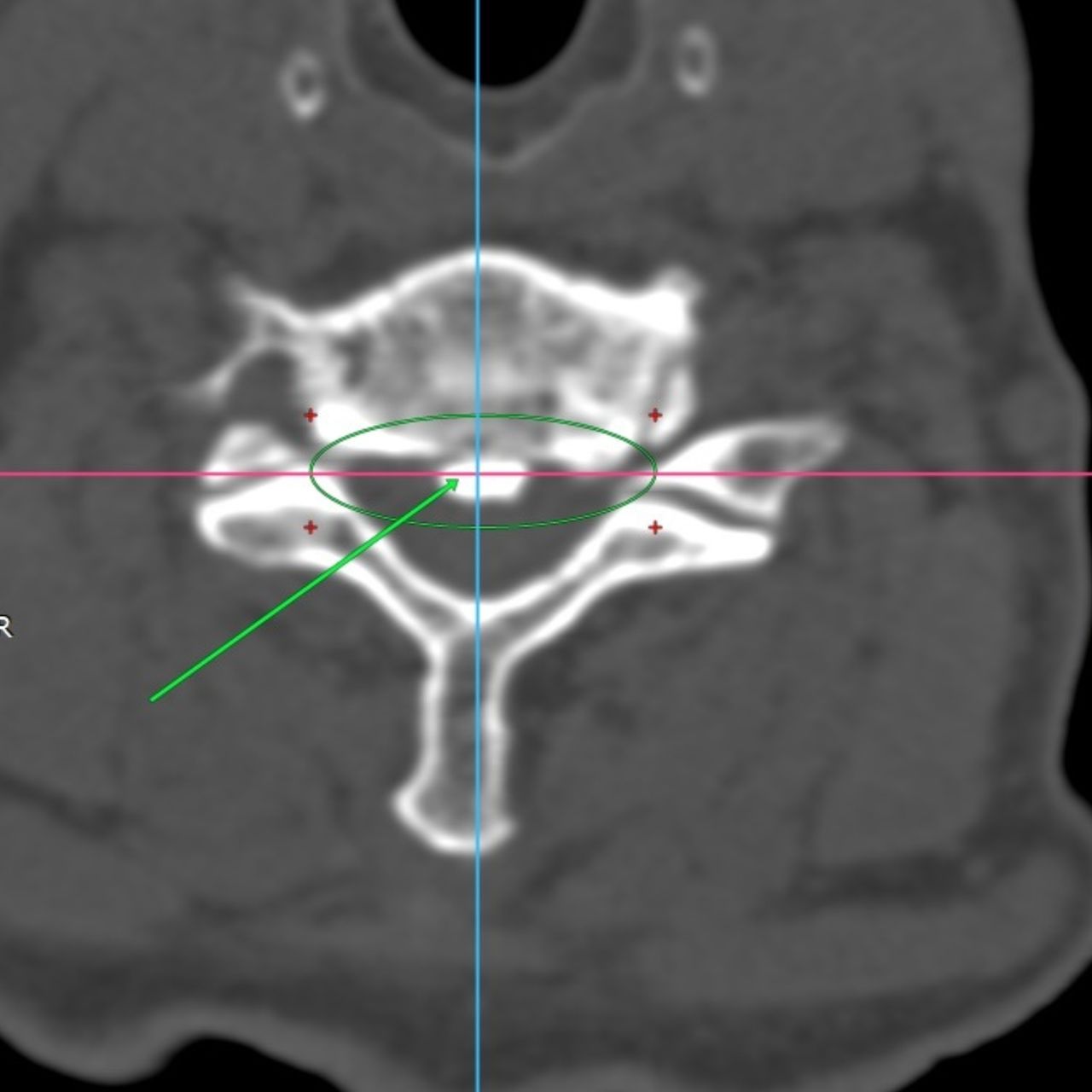 David Tafur Muñoz-1920