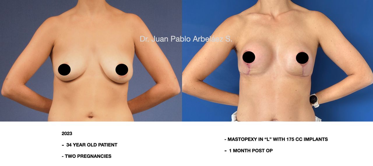 Juan Pablo Arbeláez Sierra-20