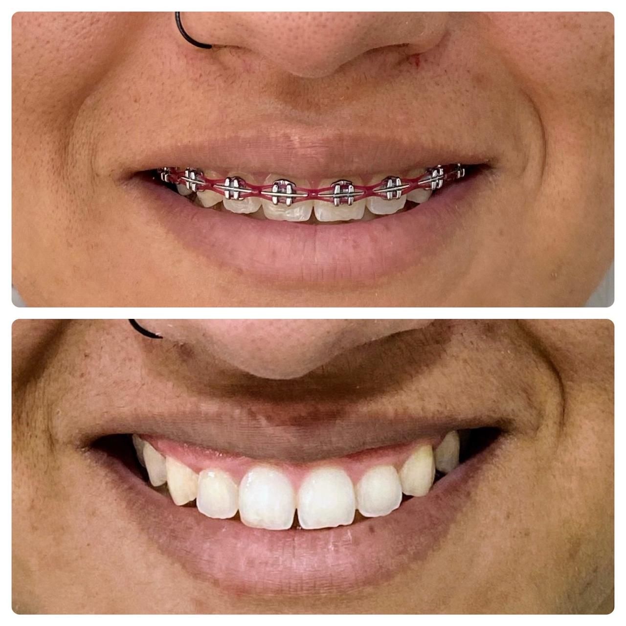 Luiz Antonio Da Silva-18