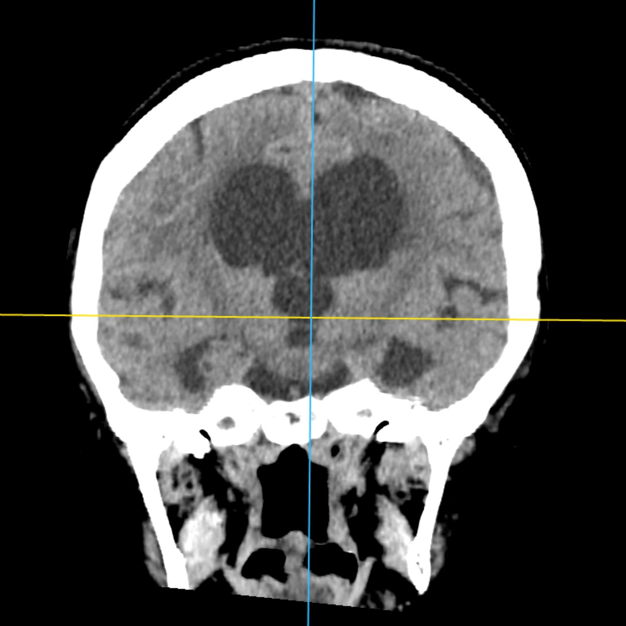 David Tafur Muñoz-2055