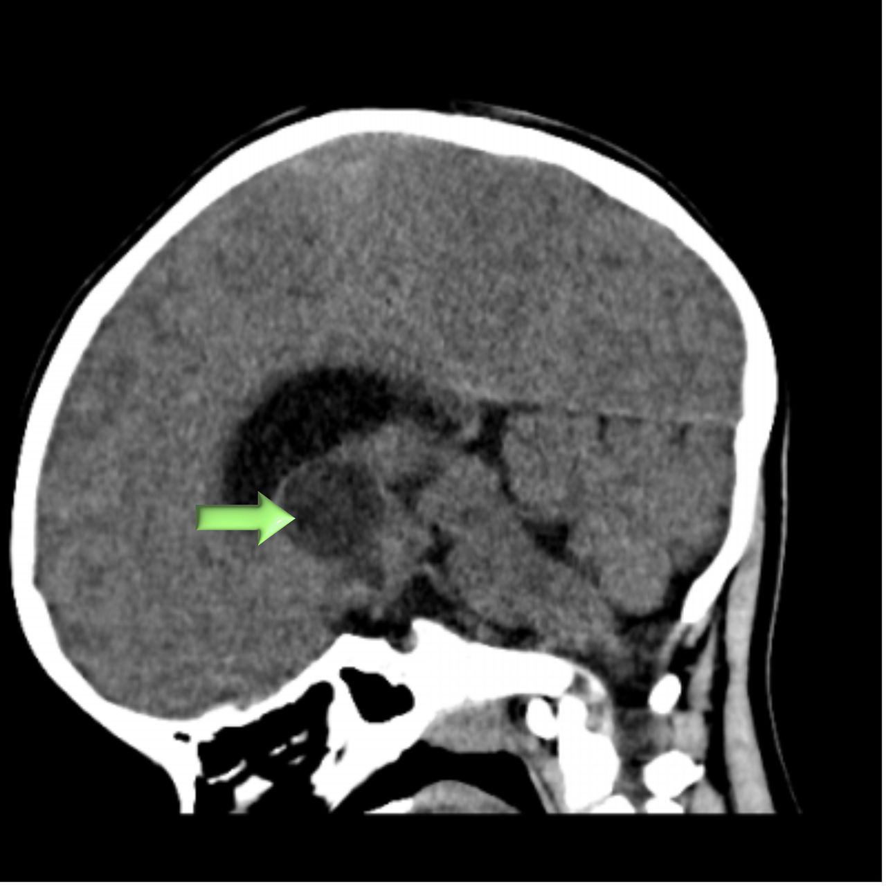 David Tafur Muñoz-1941