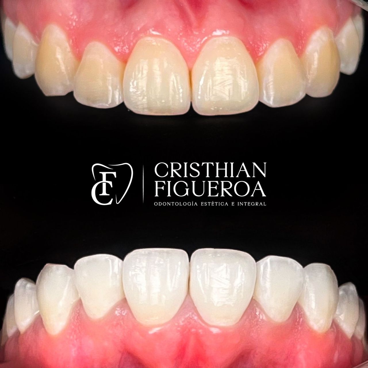Cristhian Figueroa-5