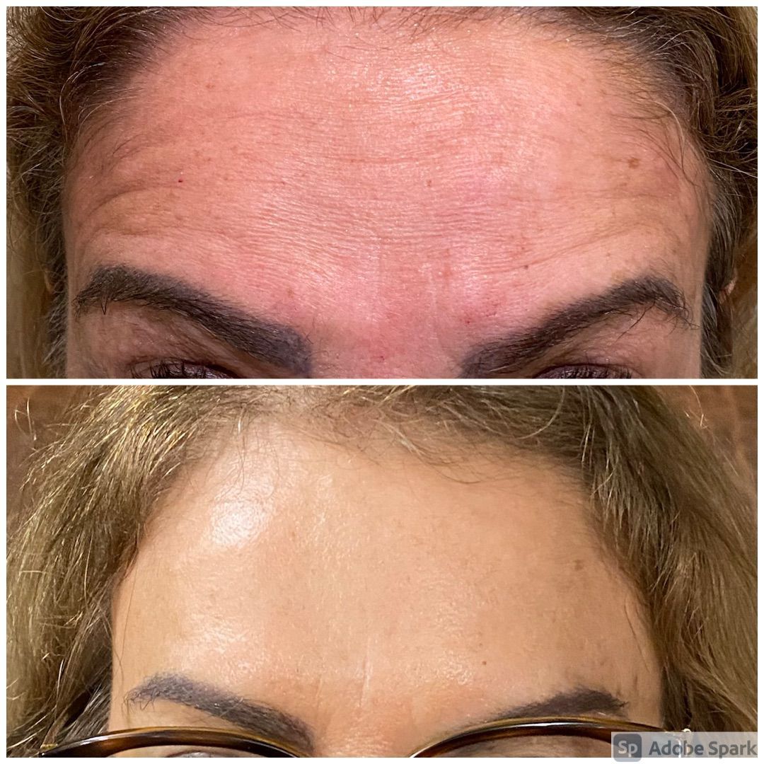 Francisco De Assis Almeida Lima Júnior-21