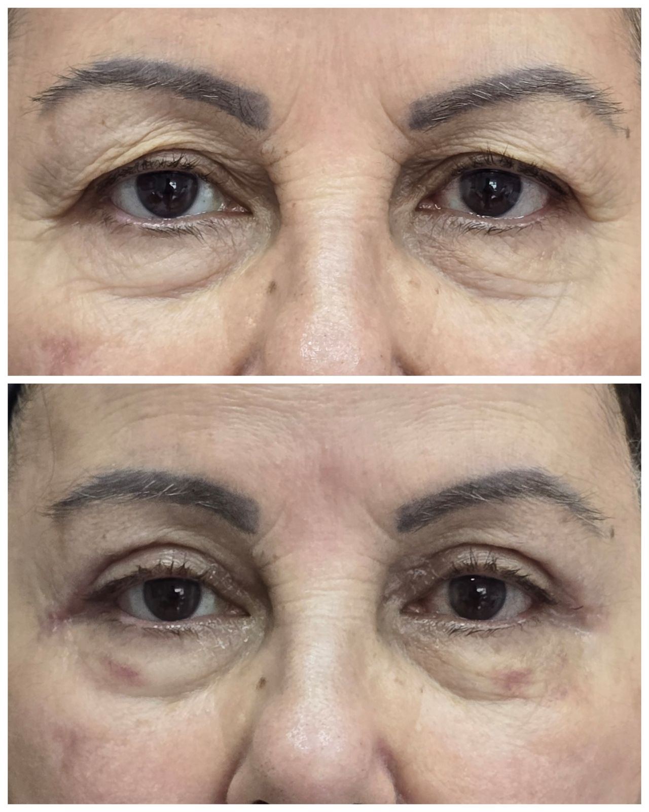 Pedro Henrique Faria Denofrio-8