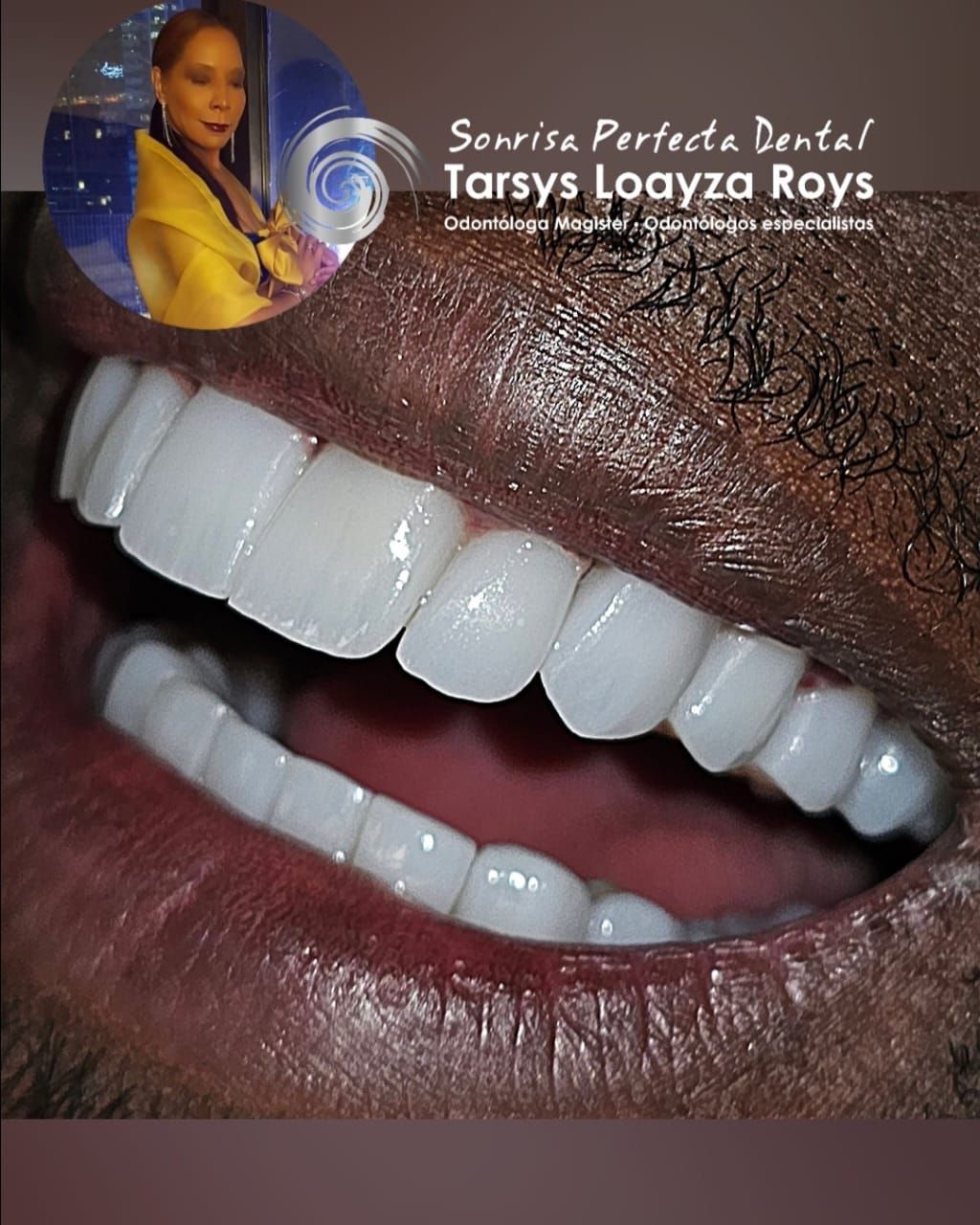 Tarsys Loayza-15