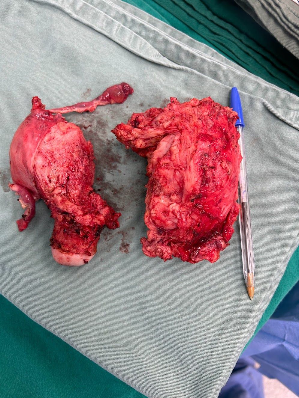 Adalberto Cesario Pereira Junior-23