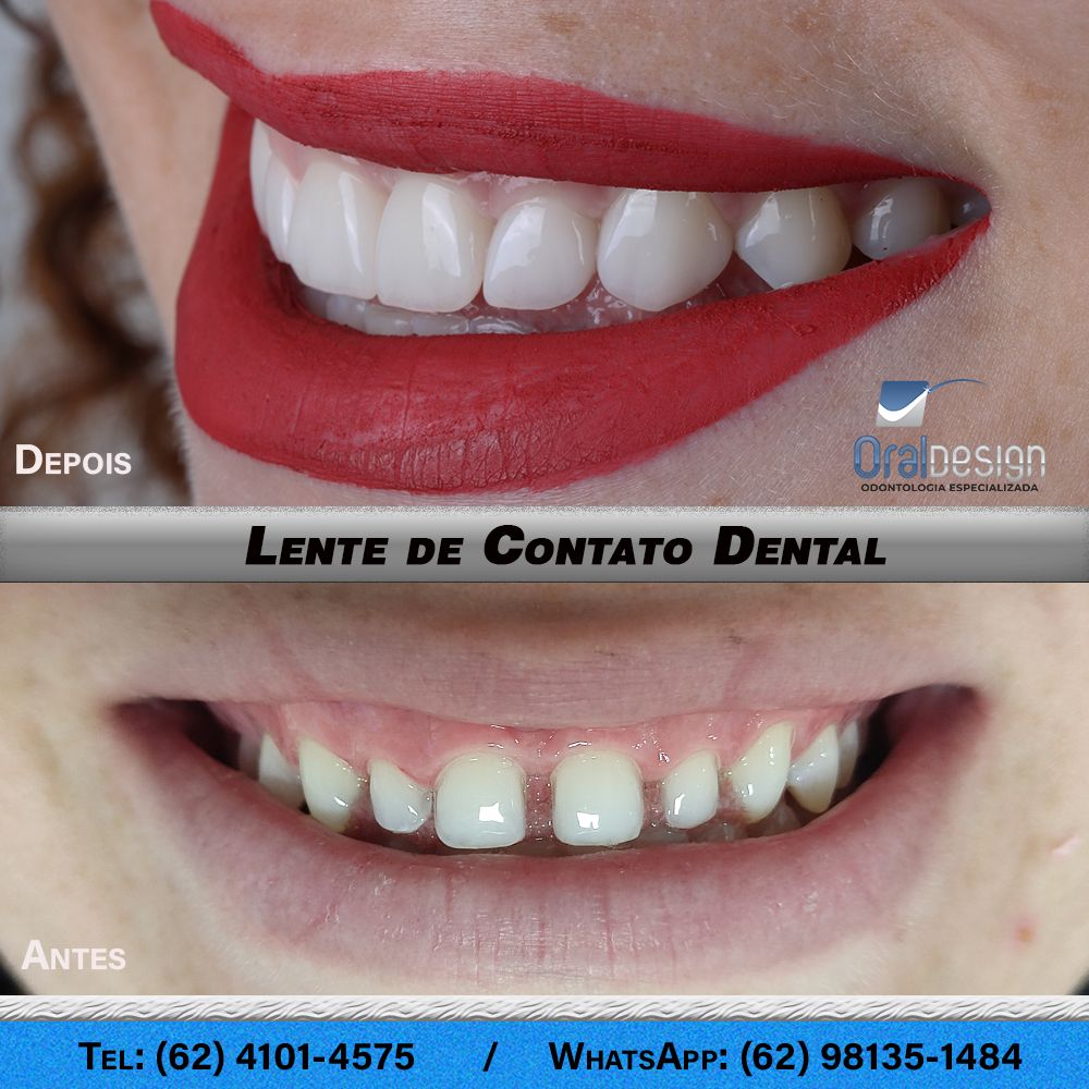 Danilo Monteiro Rezende Pereira-8