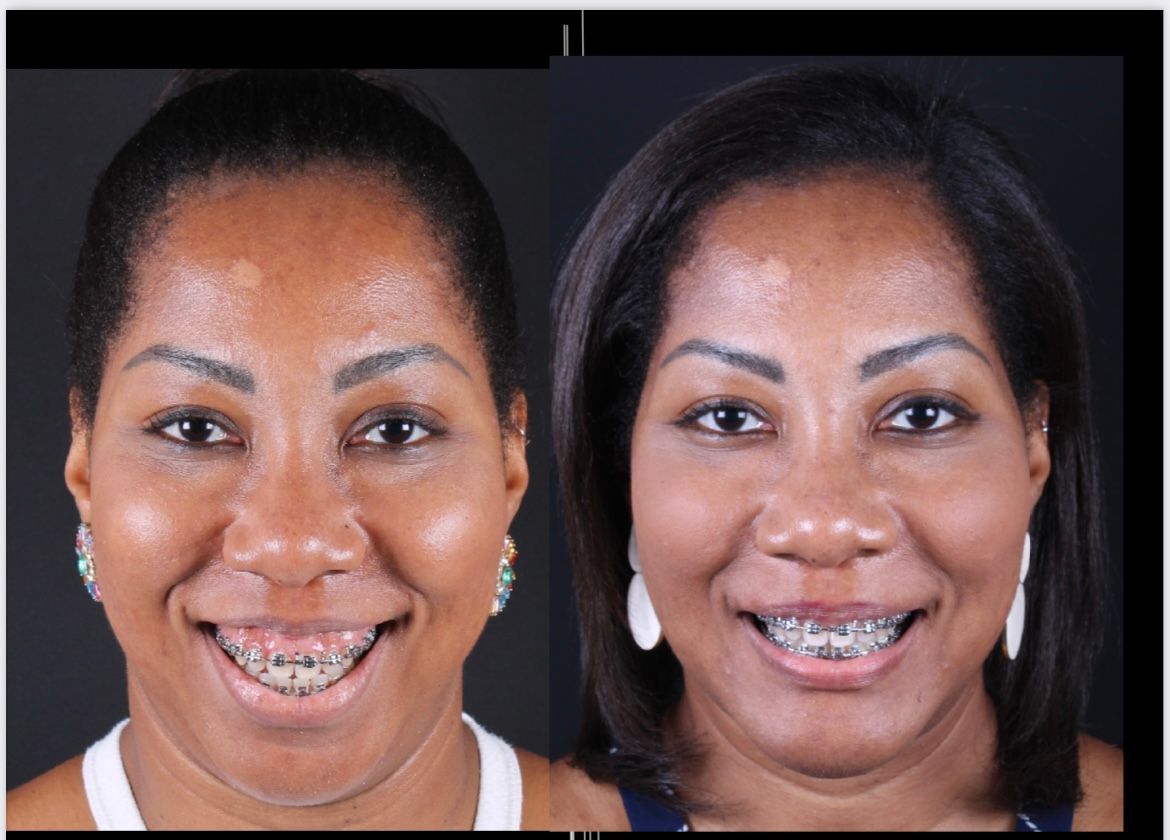 Frederico Carnevale-7