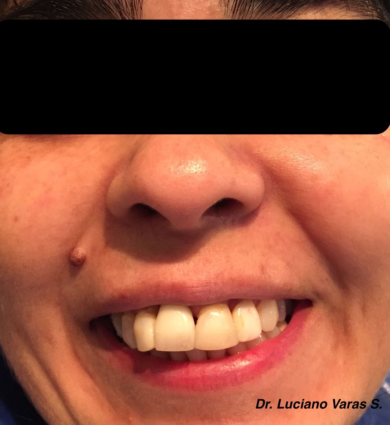 Luciano Varas Salinas-22