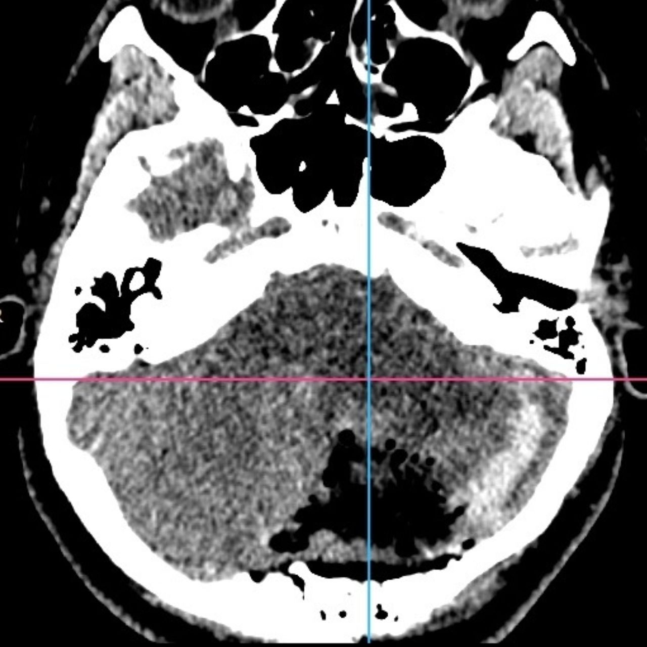 David Tafur Muñoz-1424