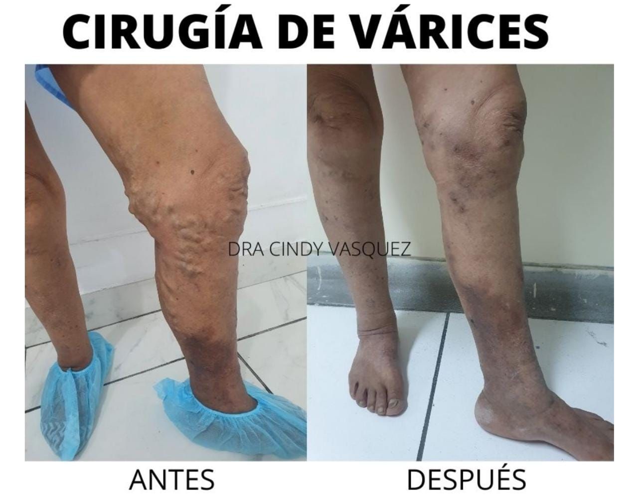 Cindy Vásquez Marzano-3