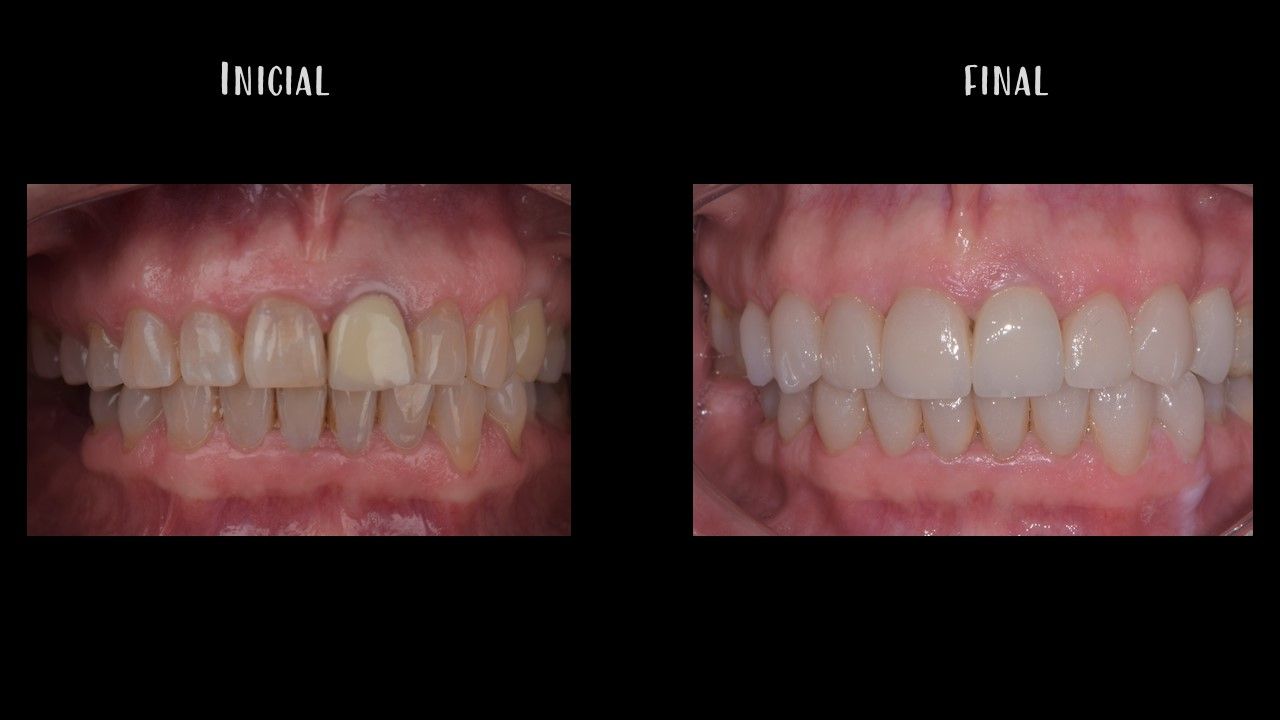 Matías Soto Parra-4