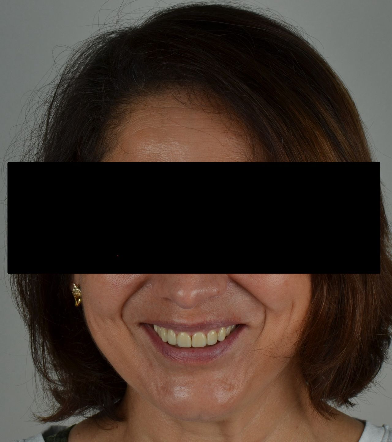 Luciano Varas Salinas-31