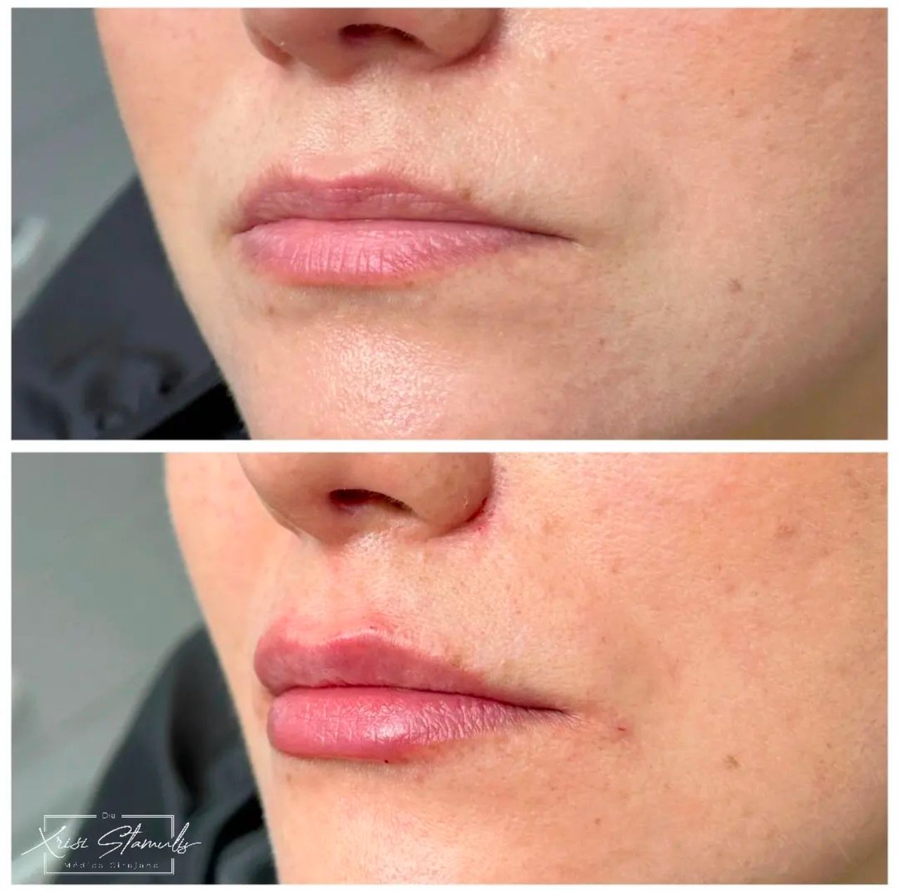 Xrisi Stamulis Rivera-6