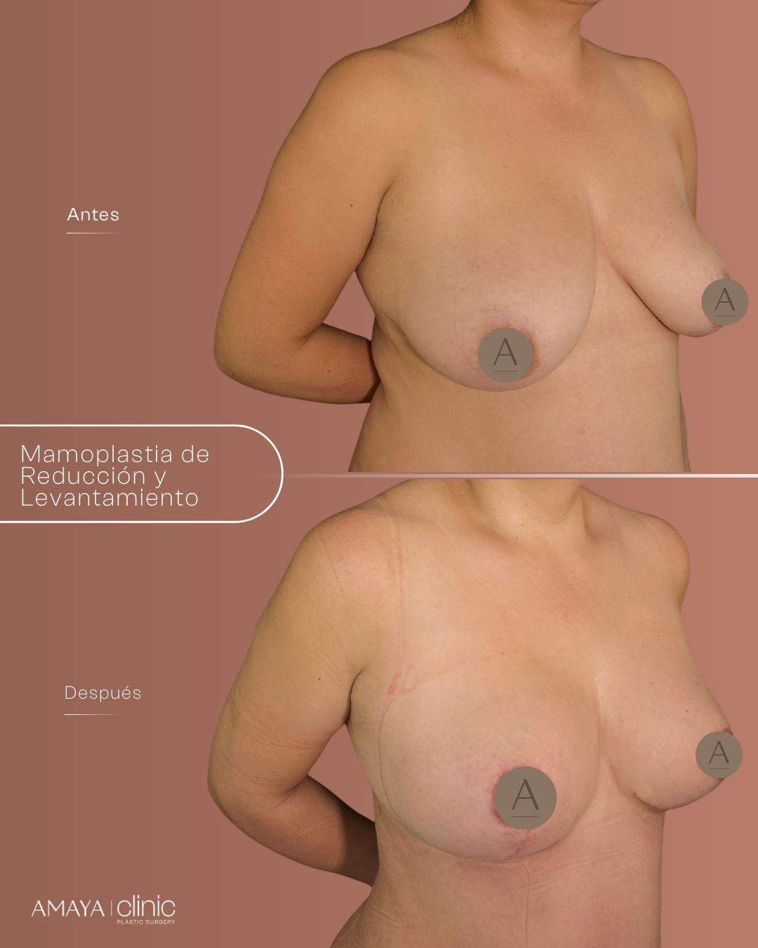 Felipe Amaya Espinosa-6