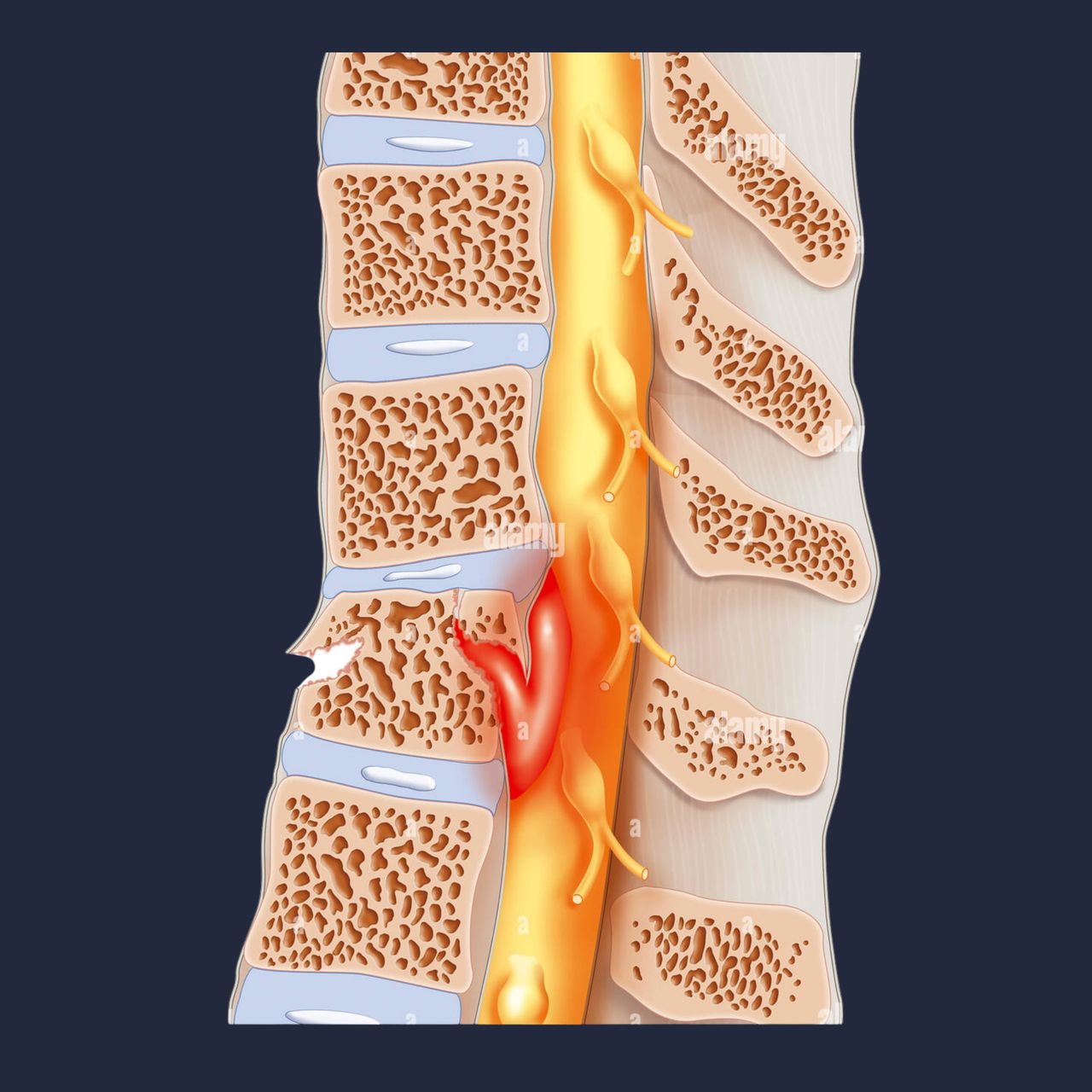 David Tafur Muñoz-2493