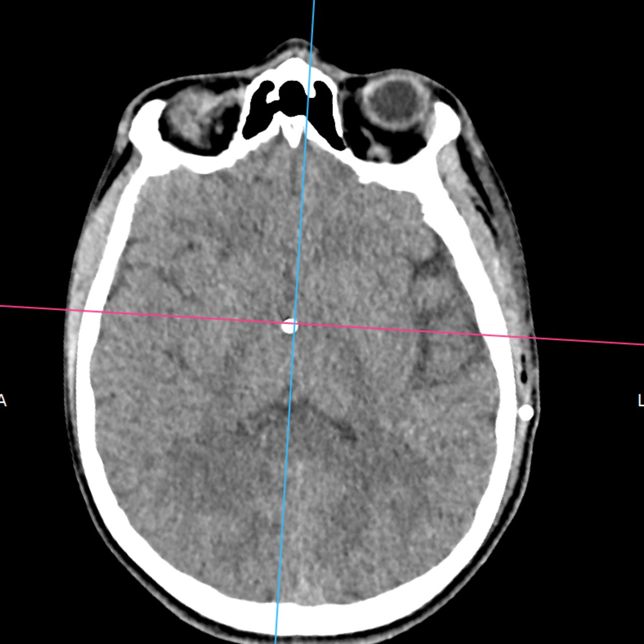David Tafur Muñoz-1735