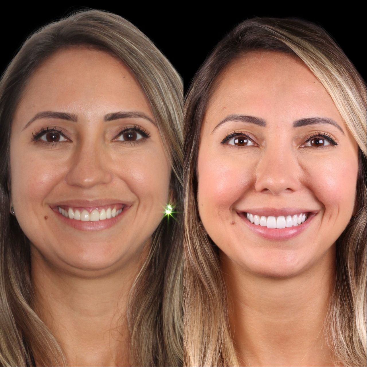 Caroline Benedeti-24