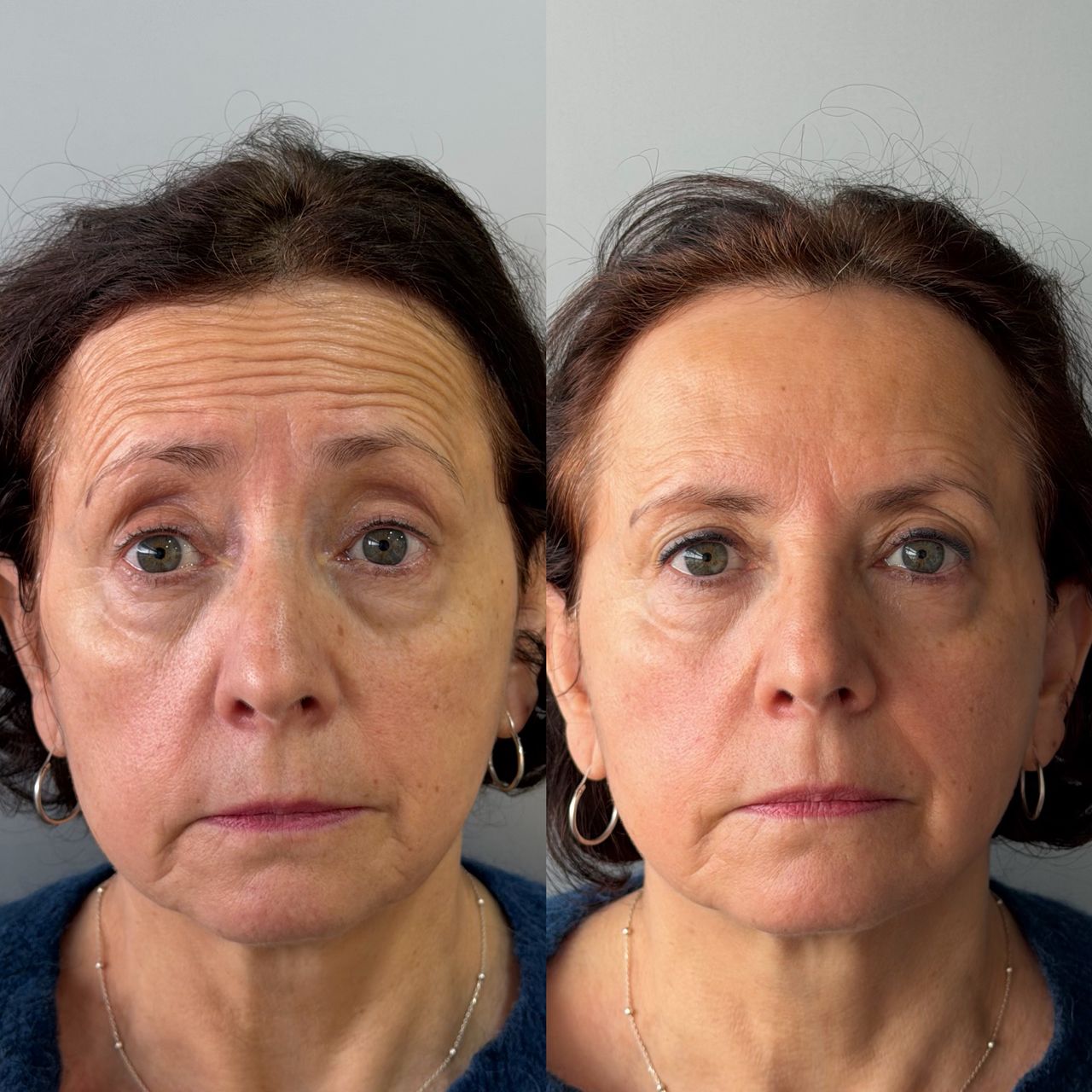 Susana Margarita Sierra Molina-22