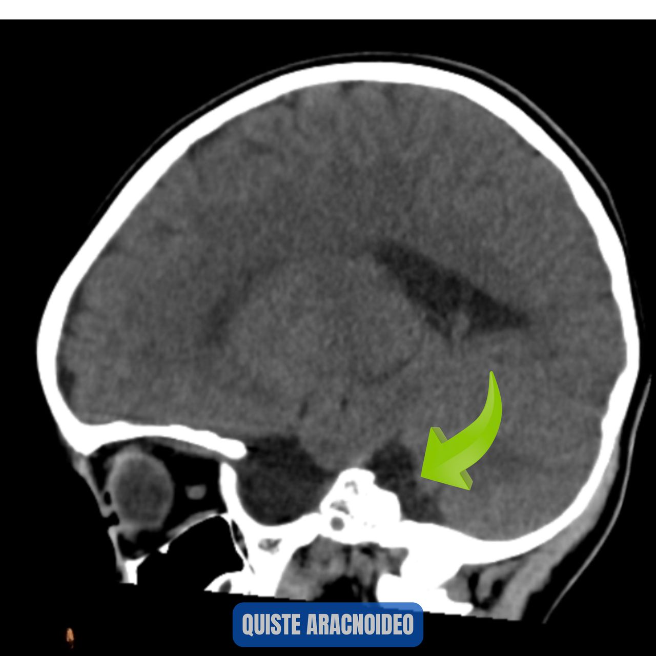 David Tafur Muñoz-1045