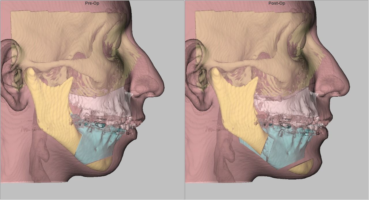 Daniel Assunção-17