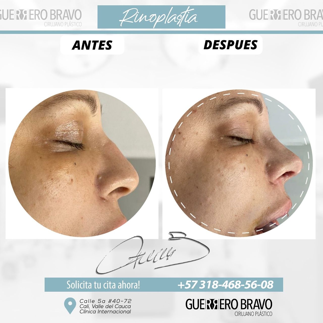 Camilo Guerrero Bravo-64