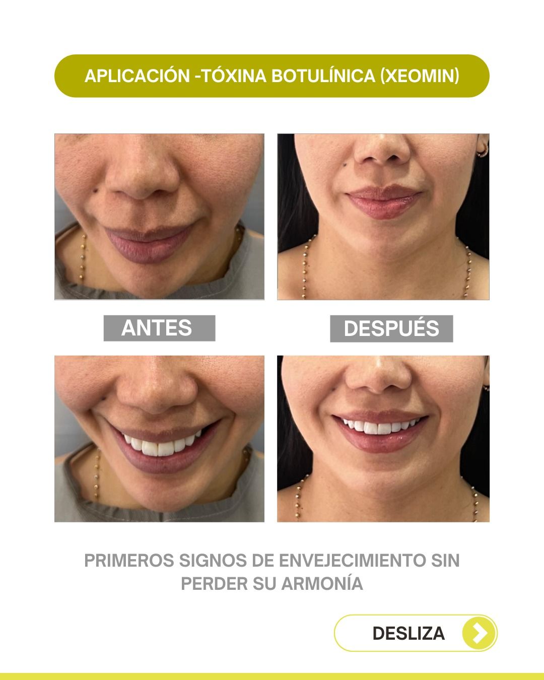 Andrea Alonso Herrera-19