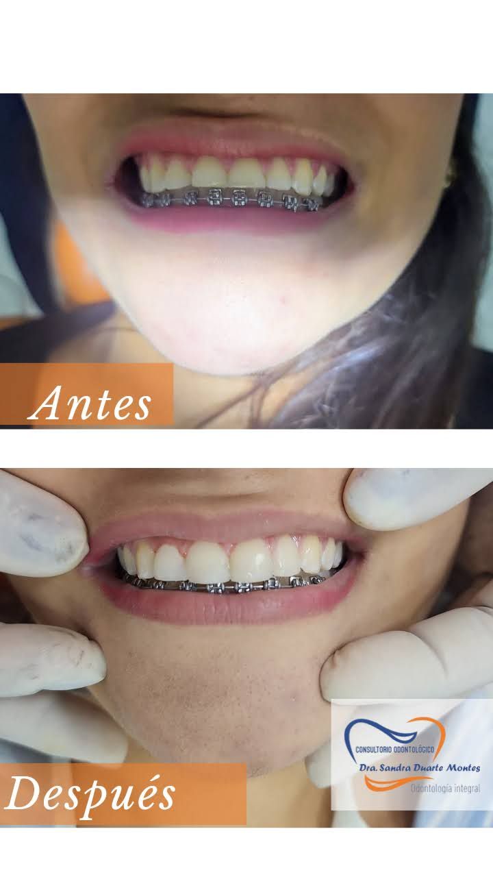 Sandra Duarte Montes-3